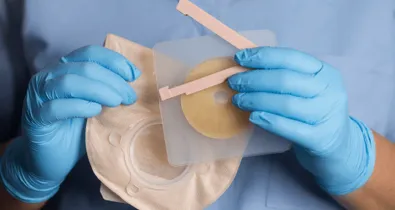 Nurse holding ostomy materials