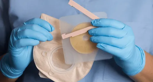 Nurse holding ostomy materials