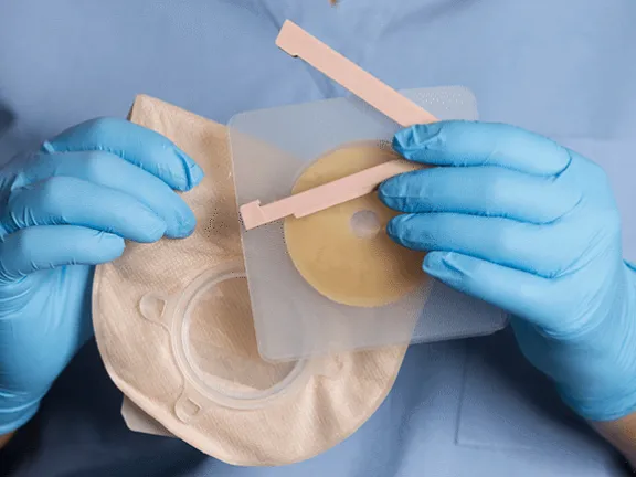 Nurse holding ostomy materials
