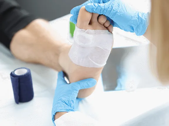 Nurse conducting diabetic wound care on a patient's foot