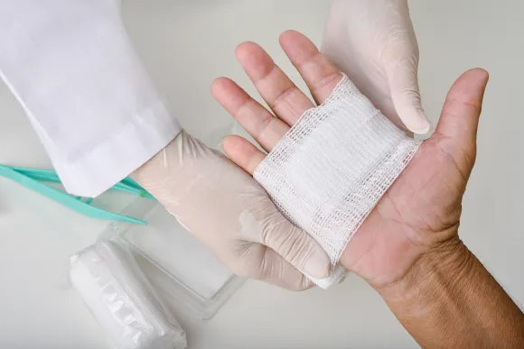 Wound Dressing